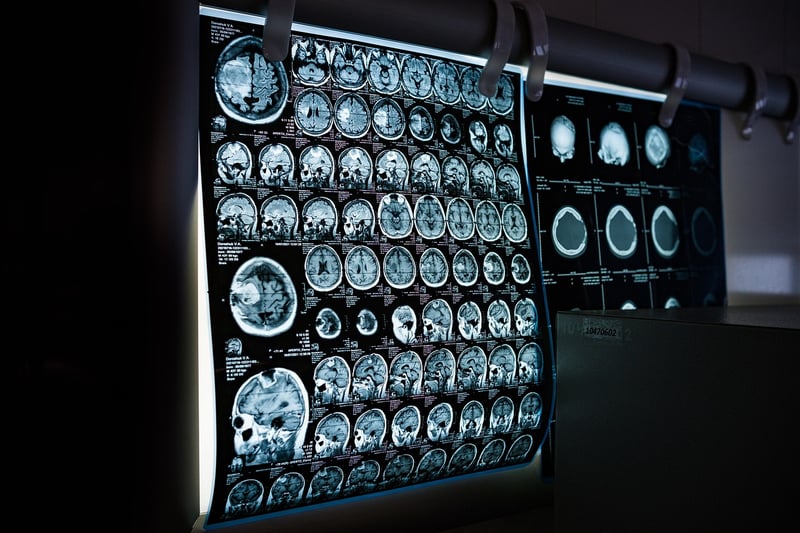 Body scan meditation
